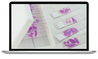 Omics-Tech-Spotlight_Webinar2_Laptop