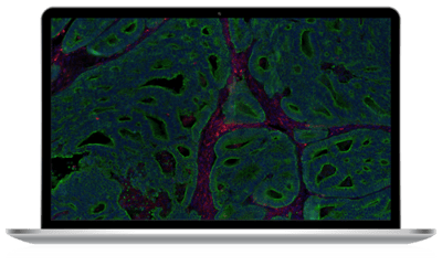 Omics-Tech-Spotlight_Webinar3_Laptop1